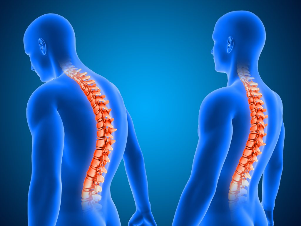 Spine, Neck & Low back Physiotherapy